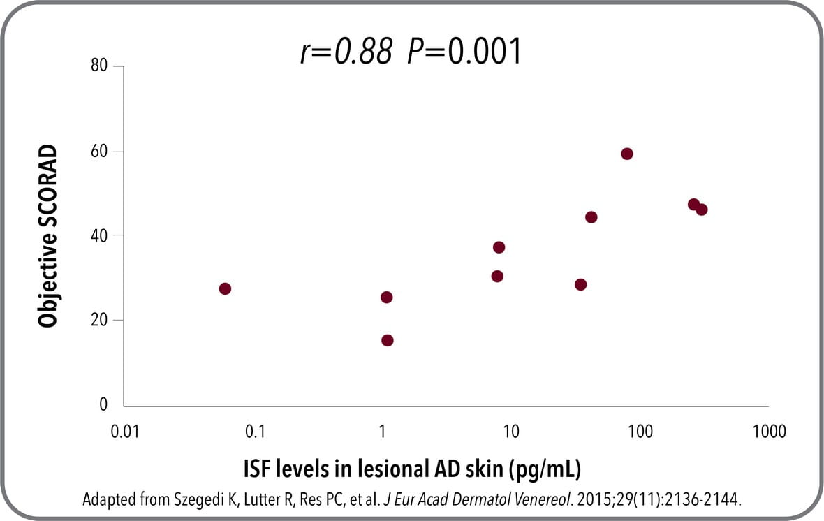 Chart created by ADKeySuspect.com showing IL-13 protein levels in lesional skin and correlation with Objective SCORAD