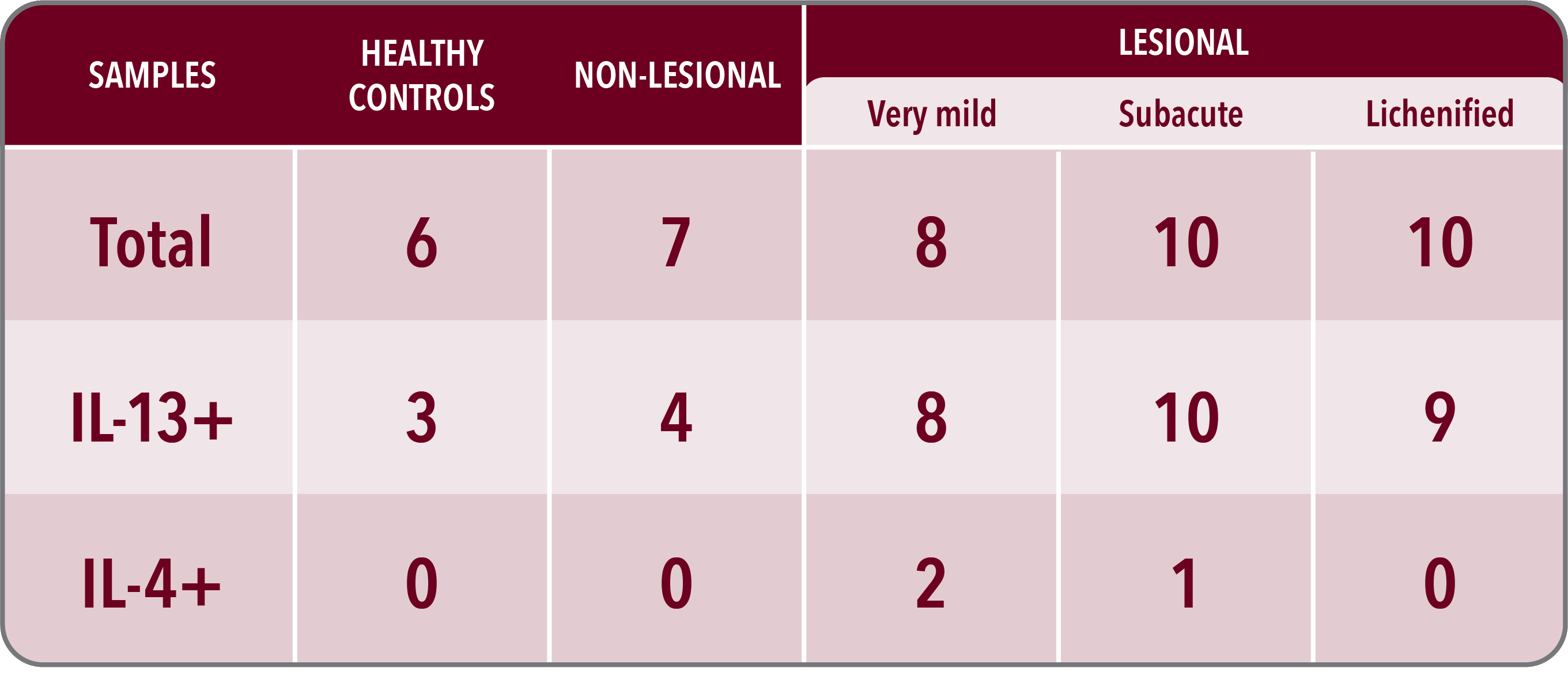 Graphic created by ADKeySuspect.com highlighting that IL-13 is more elevated than IL-4 in AD skin. Expression of IL-4 was present in 11% of skin lesions.